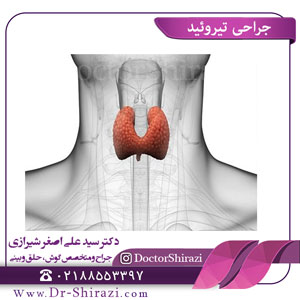 جراحی تیروئید