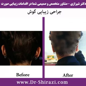 جراحی گوش
