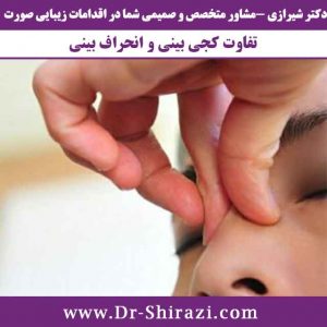 تفاوت کجی بینی و انحراف بینی