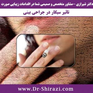 سیگار کشیدن در جراحی بینی