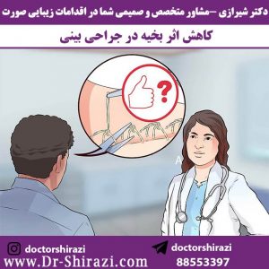 چگونگی کاهش اثر بخیه بینی در جراحی
