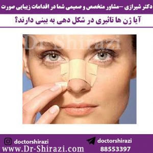تاثیر ژن در جراحی بینی