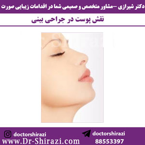 نقش-پوست-در-جراحی-بینی