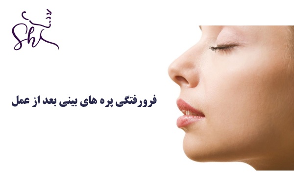 فرورفتگی پره های بینی بعد از عمل چیست؟